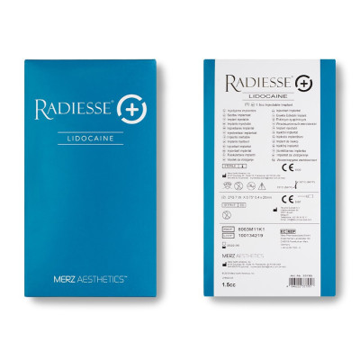 Radiesse with lidocaine - 3